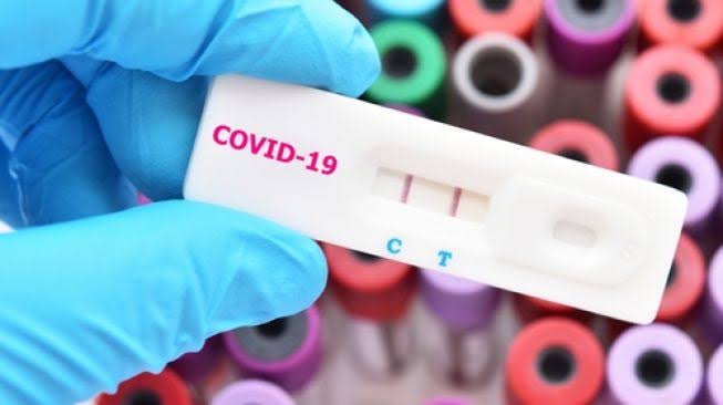 Melalui Dinas Kesehatan Pemkab Atam Buka Posko Layanan Rapid Test Yang Memerlukan Surat Keterangan Kesehatan Non Reaktif Covid-19