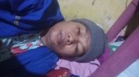 Berjuang Lawan Tumor, Warga Talun Blitar Ini Harapkan Uluran Tangan Pemerintah Dan Dermawan 