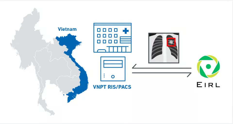 LPIXEL Menjalin Kemitraan dengan VNPT-IT untuk Menyediakan AI Pendukung Diagnosis Citra Medis “EIRL” di Vietnam